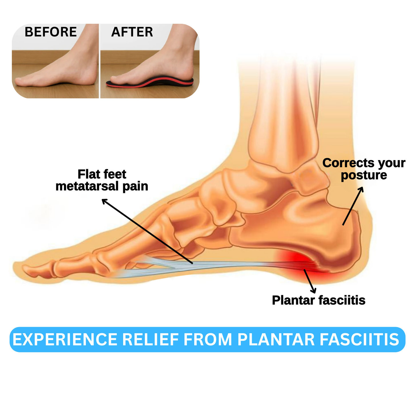 OrthoSolex Support Insoles